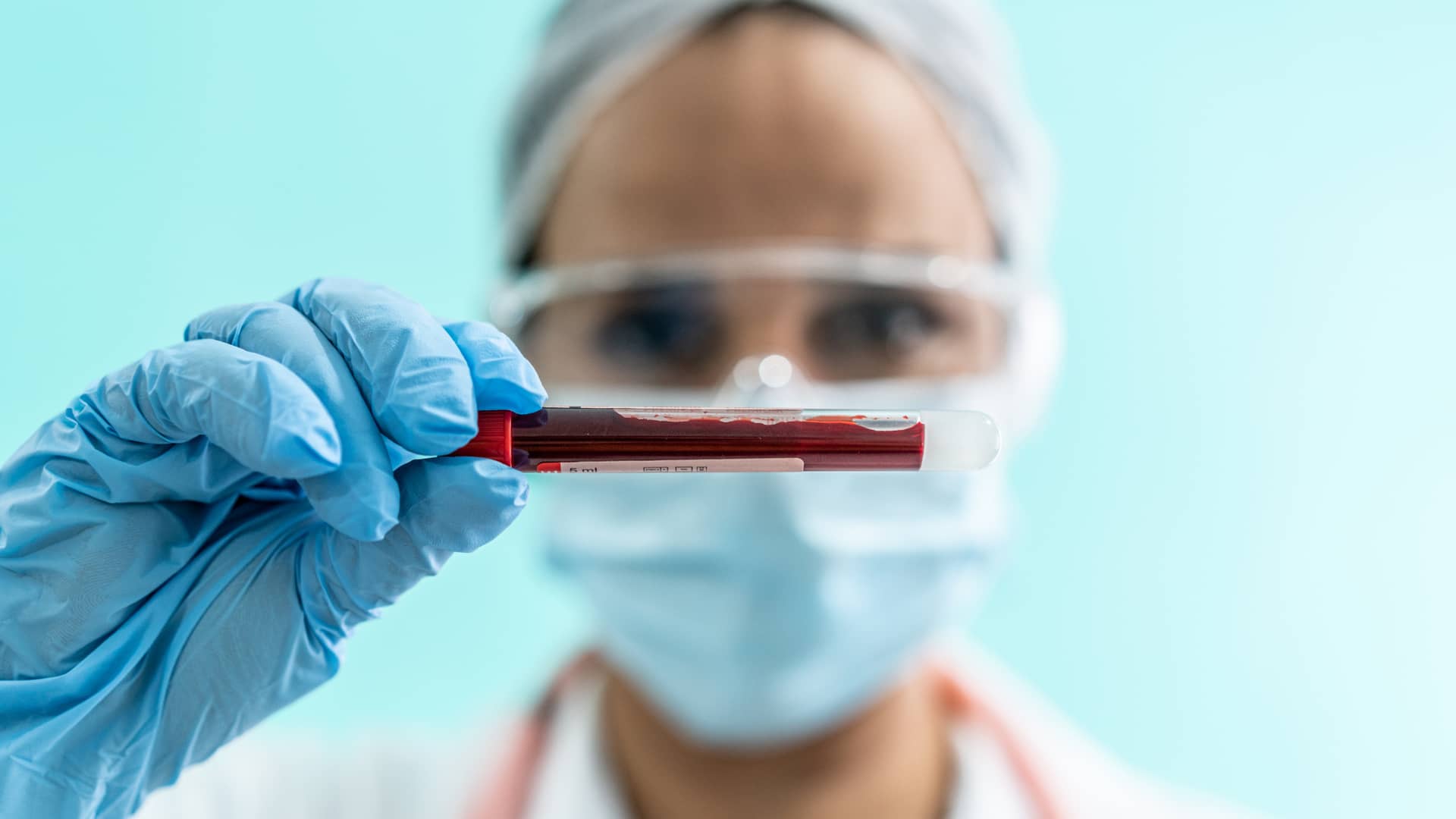 Hematólogo  del cuadro médico de adeslas a punto de analizar la sangre de un paciente asegurado