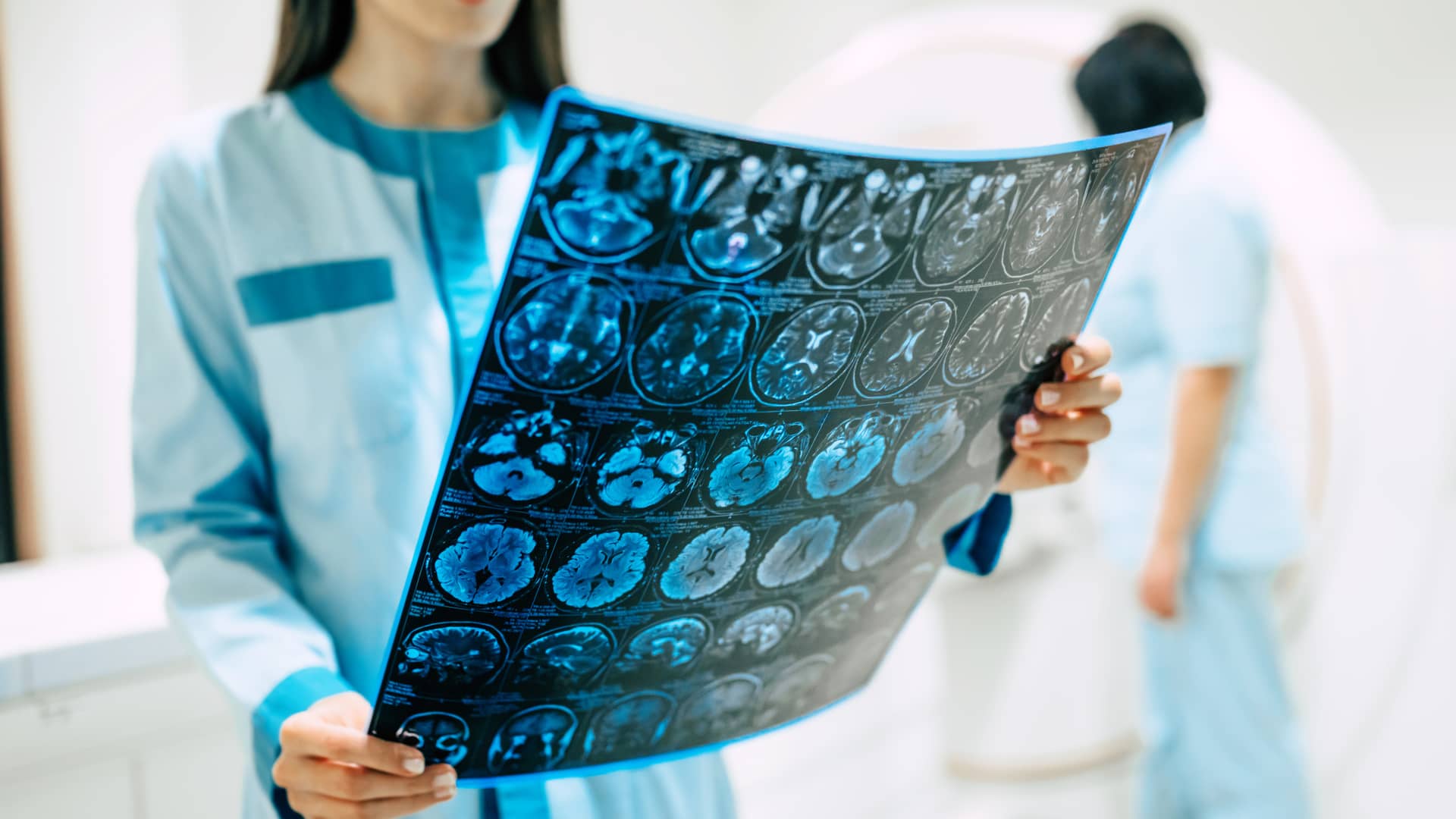 manos de una medico radiologo revisando las radiografias cerebrales de una paciente de adeslas