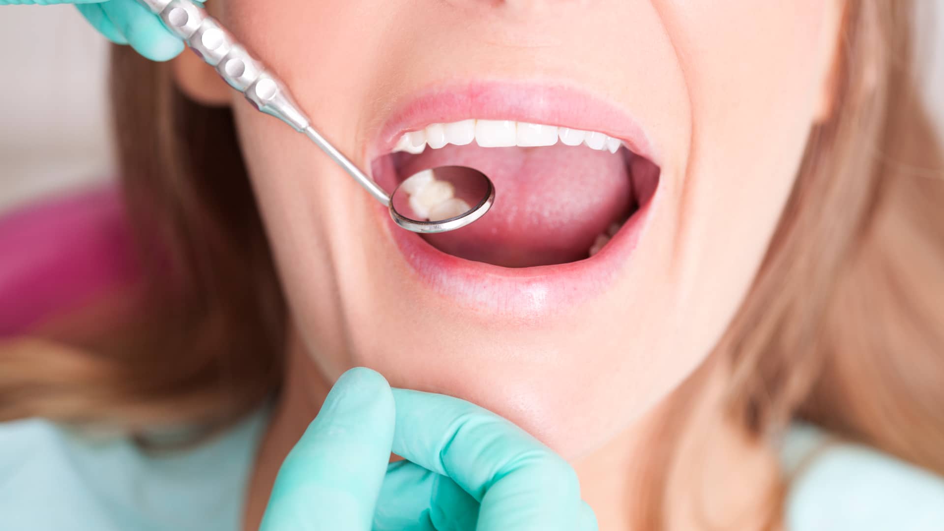 Mujer con seguro dental en divina pastora acudiendo a cita con su dentista