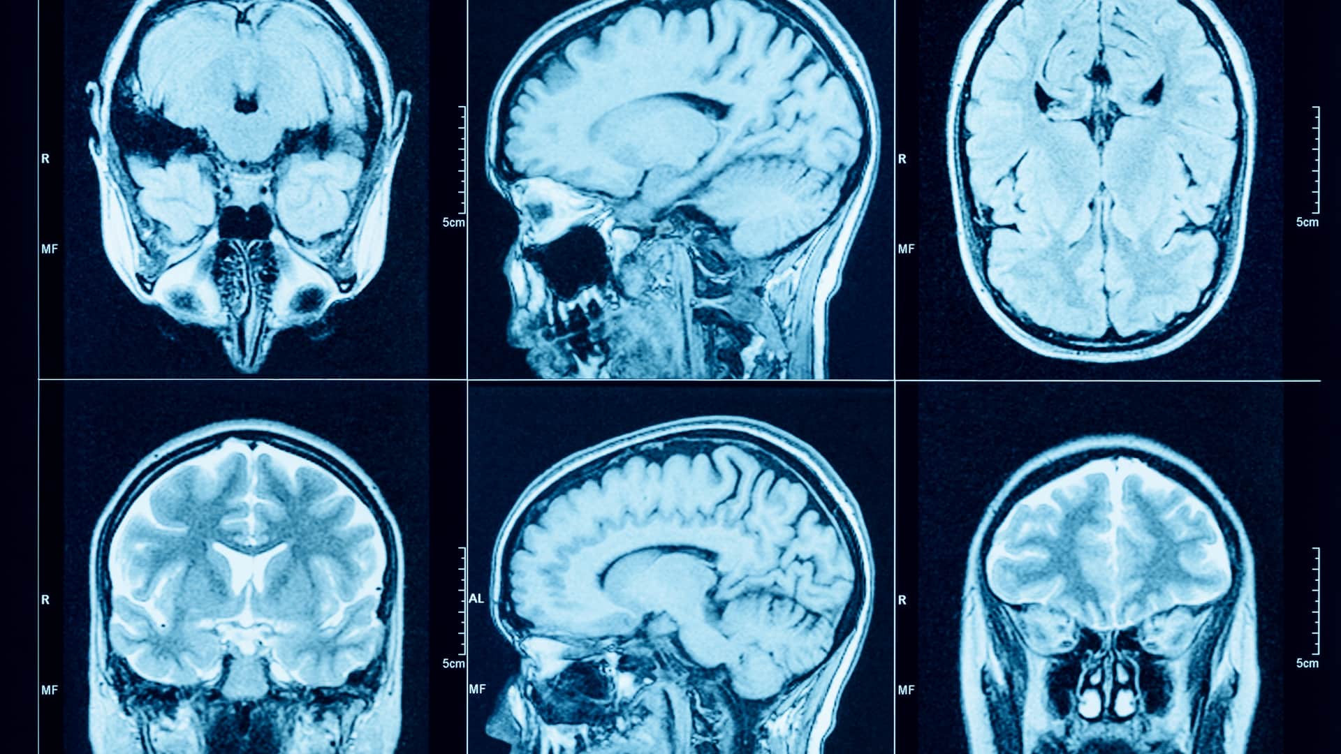 Imágenes con rayos X del cráneo un paciente pedidas por un neurólogo del cuadro médico de Mapfre
