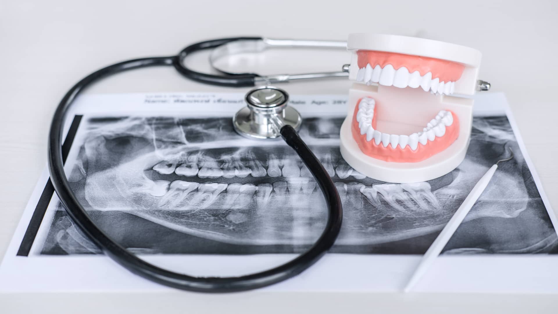 Radiografía, madíbula y estetoscopio de un maxilofacial del cuadro médico de Sanitas Radiografía, madíbula y estetoscopio de un maxilofacial del cuadro médico de Sanitas